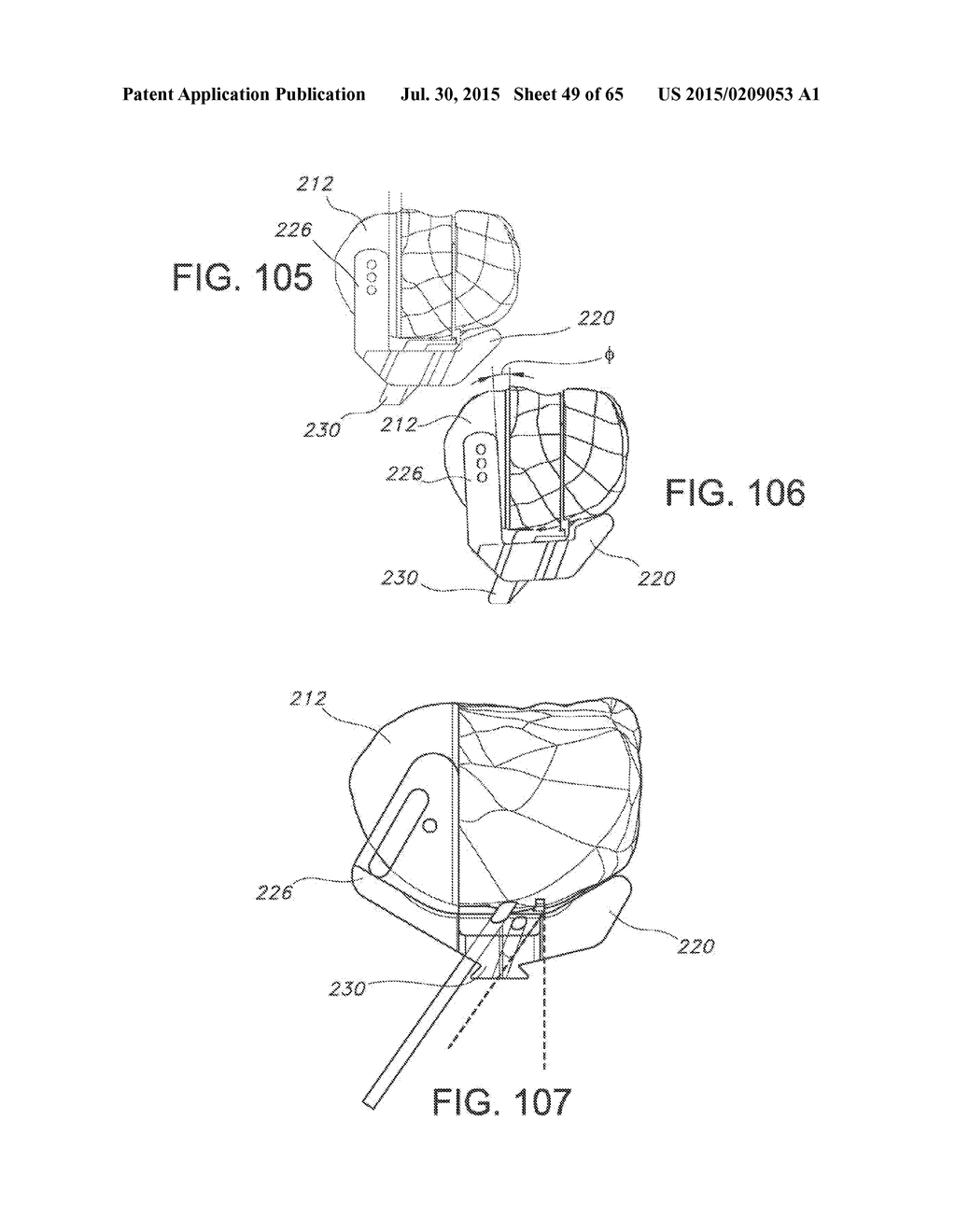 METHODS AND APPARATUS FOR PERFORMING KNEE ARTHROPLASTY - diagram, schematic, and image 50