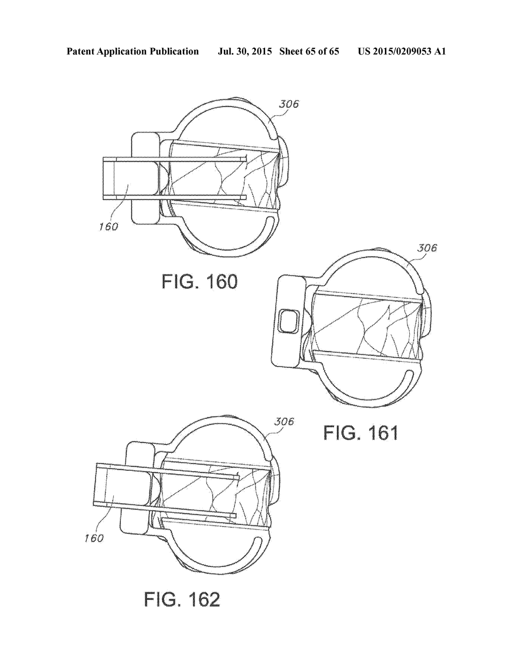 METHODS AND APPARATUS FOR PERFORMING KNEE ARTHROPLASTY - diagram, schematic, and image 66