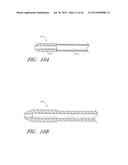 UTERINE FIBROID TISSUE REMOVAL DEVICE diagram and image