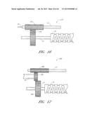 UTERINE FIBROID TISSUE REMOVAL DEVICE diagram and image