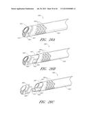 UTERINE FIBROID TISSUE REMOVAL DEVICE diagram and image