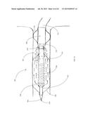 COOLED MICROWAVE DENERVATION CATHETER CONFIGURATION diagram and image