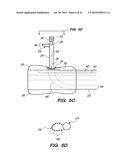 SYSTEM AND METHOD FOR ENDOLUMINAL AND TRANSLUMENAL THERAPY diagram and image