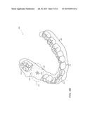 ADHESIVE OBJECTS FOR IMPROVING IMAGE REGISTRATION OF INTRAORAL IMAGES diagram and image