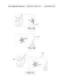 ADHESIVE OBJECTS FOR IMPROVING IMAGE REGISTRATION OF INTRAORAL IMAGES diagram and image