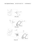 ADHESIVE OBJECTS FOR IMPROVING IMAGE REGISTRATION OF INTRAORAL IMAGES diagram and image