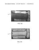 ADHESIVE OBJECTS FOR IMPROVING IMAGE REGISTRATION OF INTRAORAL IMAGES diagram and image