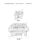 ORTHODONTIC BRACKET AND METHOD OF CORRECTING MALPOSITIONED TEETH diagram and image