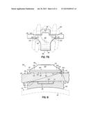 ORTHODONTIC BRACKET AND METHOD OF CORRECTING MALPOSITIONED TEETH diagram and image