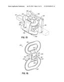 ORTHODONTIC BRACKET AND METHOD OF CORRECTING MALPOSITIONED TEETH diagram and image