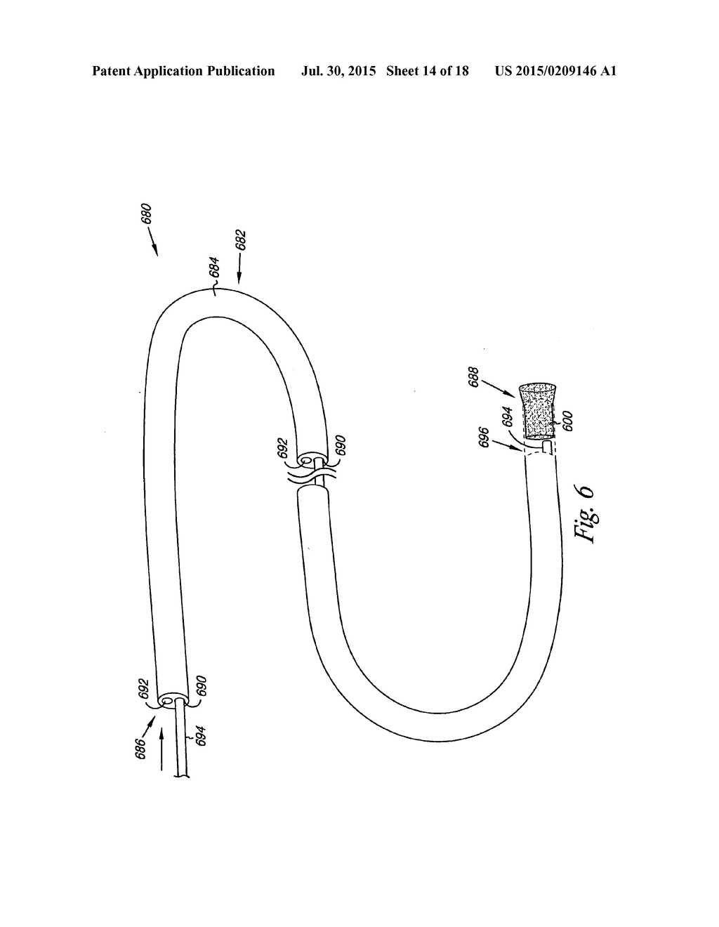 Venous Valve, System, and Method - diagram, schematic, and image 15