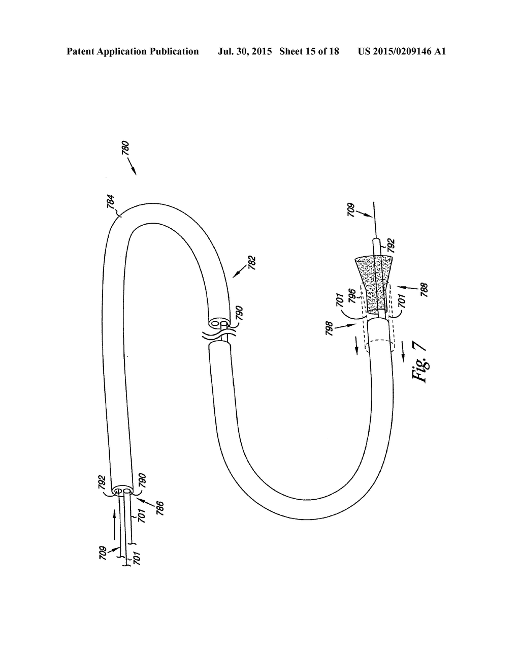 Venous Valve, System, and Method - diagram, schematic, and image 16