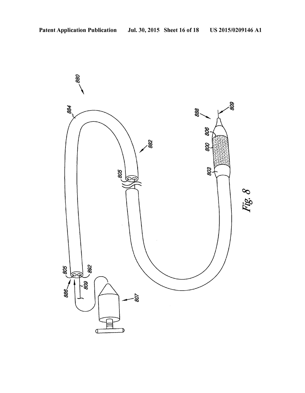 Venous Valve, System, and Method - diagram, schematic, and image 17