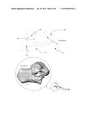 SYSTEM AND METHOD FOR MODIFYING TALOCALCANEAL RELATIONSHIP IN A FOOT diagram and image