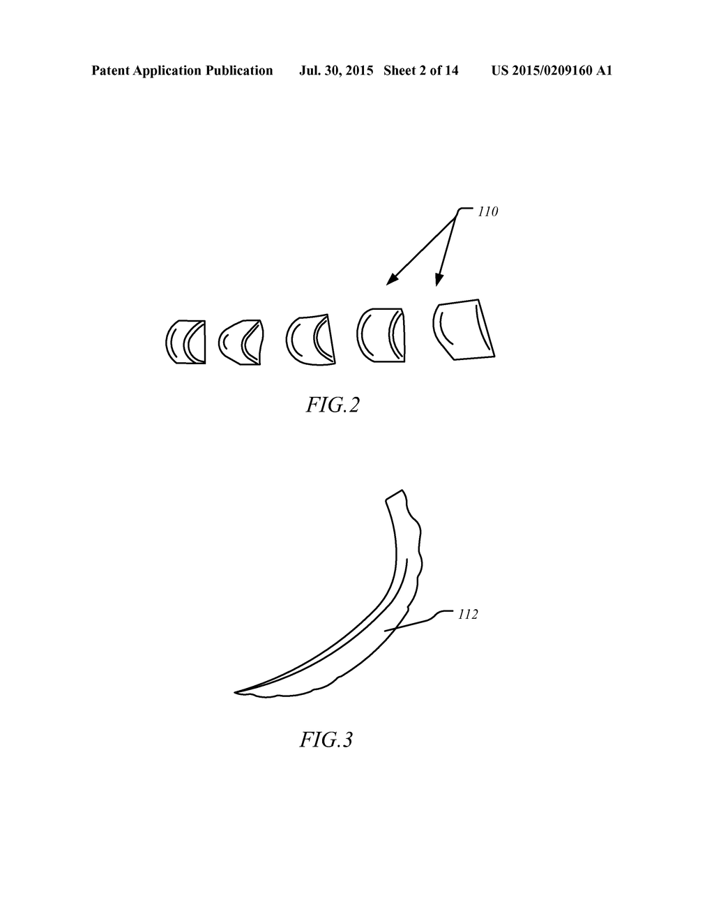 PROSTHETIC SPORT FEET - diagram, schematic, and image 03