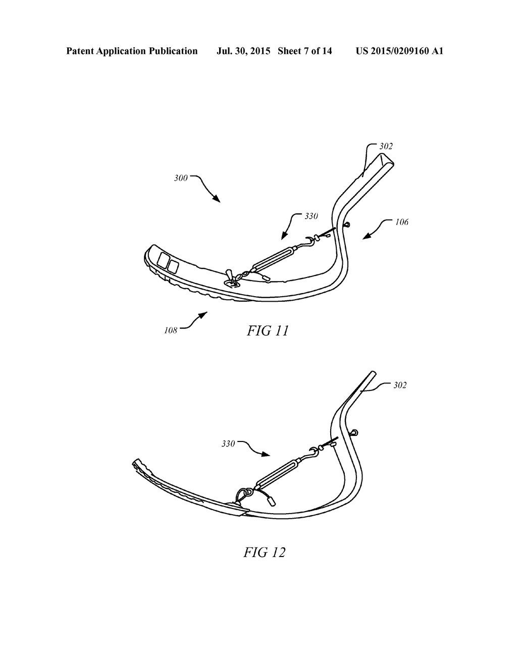 PROSTHETIC SPORT FEET - diagram, schematic, and image 08