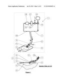 APPARATUS FOR ASPIRATING, IRRIGATING AND CLEANSING WOUNDS diagram and image