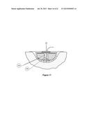 APPARATUS FOR ASPIRATING, IRRIGATING AND CLEANSING WOUNDS diagram and image