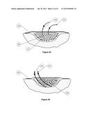 APPARATUS FOR ASPIRATING, IRRIGATING AND CLEANSING WOUNDS diagram and image