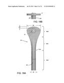 BLOOD PUMP SYSTEMS AND METHODS diagram and image