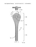 BLOOD PUMP SYSTEMS AND METHODS diagram and image