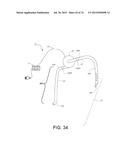 BLOOD PUMP SYSTEMS AND METHODS diagram and image