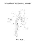 BLOOD PUMP SYSTEMS AND METHODS diagram and image