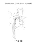 BLOOD PUMP SYSTEMS AND METHODS diagram and image