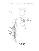 BLOOD PUMP SYSTEMS AND METHODS diagram and image