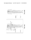 BLOOD PUMP SYSTEMS AND METHODS diagram and image