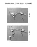 BLOOD PUMP SYSTEMS AND METHODS diagram and image