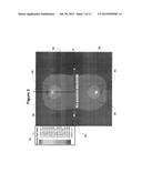 PASSIVE ELECTRIC FIELD FOCUS SYSTEM FOR IN VIVO AND IN VITRO APPLICATIONS diagram and image