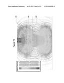 PASSIVE ELECTRIC FIELD FOCUS SYSTEM FOR IN VIVO AND IN VITRO APPLICATIONS diagram and image