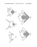 CO-INJECTION MOLDED MULTI-LAYER ARTICLE WITH INJECTION-FORMED APERTURE     BETWEEN GATE AREA AND PERIPHERAL EDGE diagram and image