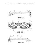 SYSTEMS AND METHODS FOR ATTACHMENT OF VEHICLE ACCESSORIES diagram and image