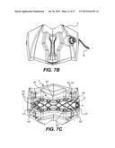 SYSTEMS AND METHODS FOR ATTACHMENT OF VEHICLE ACCESSORIES diagram and image