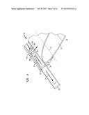 Compliant Structure Design for Varying Surface Contours diagram and image