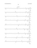 PROTEASE STABILIZED ACYLATED INSULIN ANALOGUES diagram and image