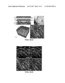 METHOD AND APPARATUS FOR ULTRAHIGH SENSITIVE OPTICAL MICROANGIOGRAPHY diagram and image