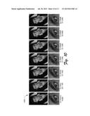 Image Prior as a Shared Basis Mixture Model diagram and image