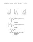 Method of Reconstituting Cellular Spectra Useful for Detecting Cellular     Disorders diagram and image