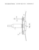 DETACHABLE VEHICLE-MOUNTED BANNER ASSEMBLY HAVING IMPROVED DISPLAY AND     MOUNTING FEATURES diagram and image