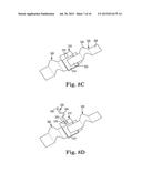 SEMICONDUCTOR DEVICE INCLUDING FLEXIBLE LEADS diagram and image