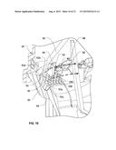 VIBRATIONAL SEED-DOUBLE ELIMINATOR FOR A PLANTING UNIT diagram and image