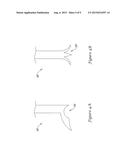 Biliary Catheter Systems Including Stabilizing Members diagram and image