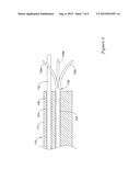 Biliary Catheter Systems Including Stabilizing Members diagram and image