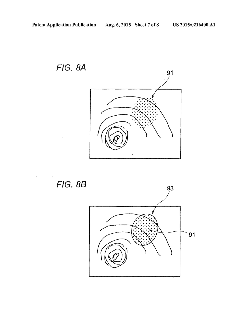 ENDOSCOPIC DEVICE - diagram, schematic, and image 08