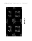 Background Suppression by Time Dependent Flip Angle of Saturation Pulses diagram and image