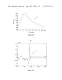 INTRINSIC FREQUENCY HEMODYNAMIC WAVEFORM ANALYSIS diagram and image