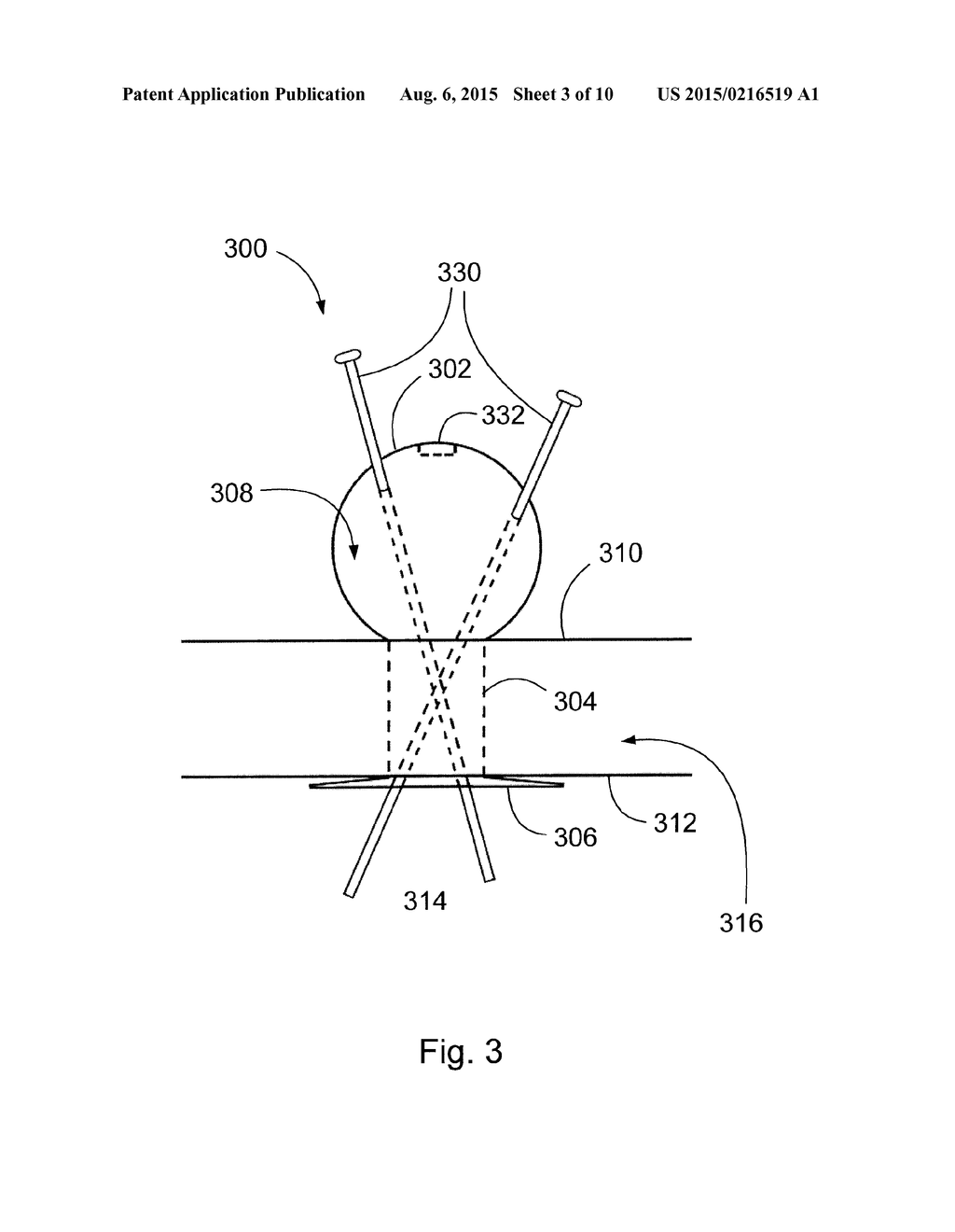 TRANS-ENDOSCOPIC AND LAPAROSCOPIC SURGERY PORT - diagram, schematic, and image 04